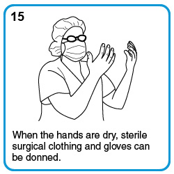 When the hands are dry, sterile surgical clothing and gloves can be donned.